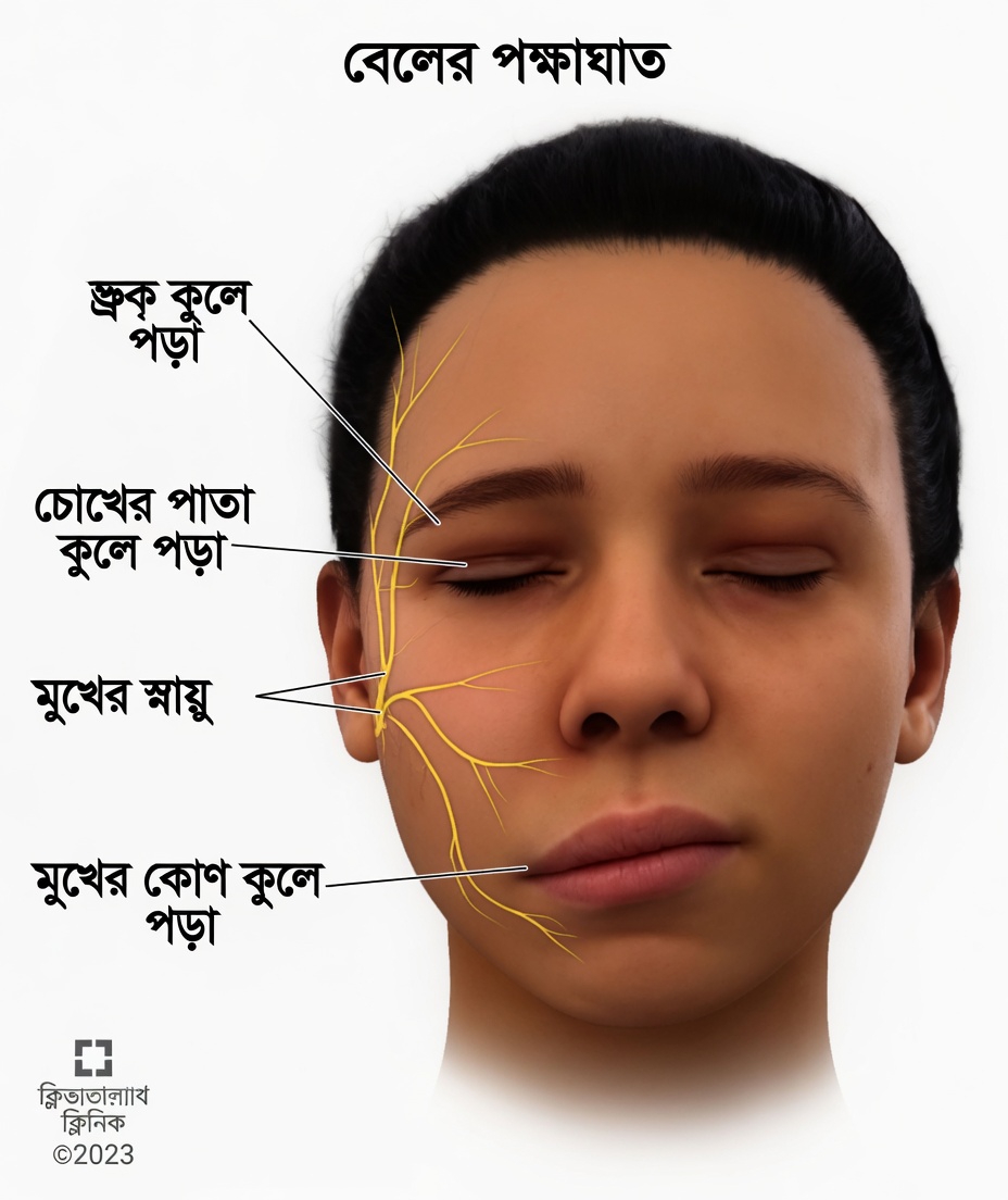 ঘুমের সময় মুখাবয়বের কোন পরিবর্তনগুলো মস্তিষ্কের স্বাস্থ্যের ঝুঁকির ইঙ্গিত দিতে পারে