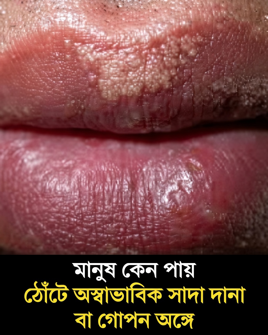 মানুষ কেন তাদের ঠোঁট বা গোপনাঙ্গে অস্বাভাবিক ছোট সাদা দানা লক্ষ্য করে: একটি সহজ নির্দেশিকা