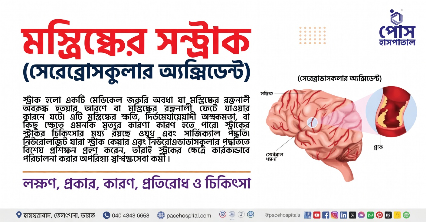 ঘুমের এই লক্ষণটি কি স্ট্রোকের সতর্কসংকেত হতে পারে?