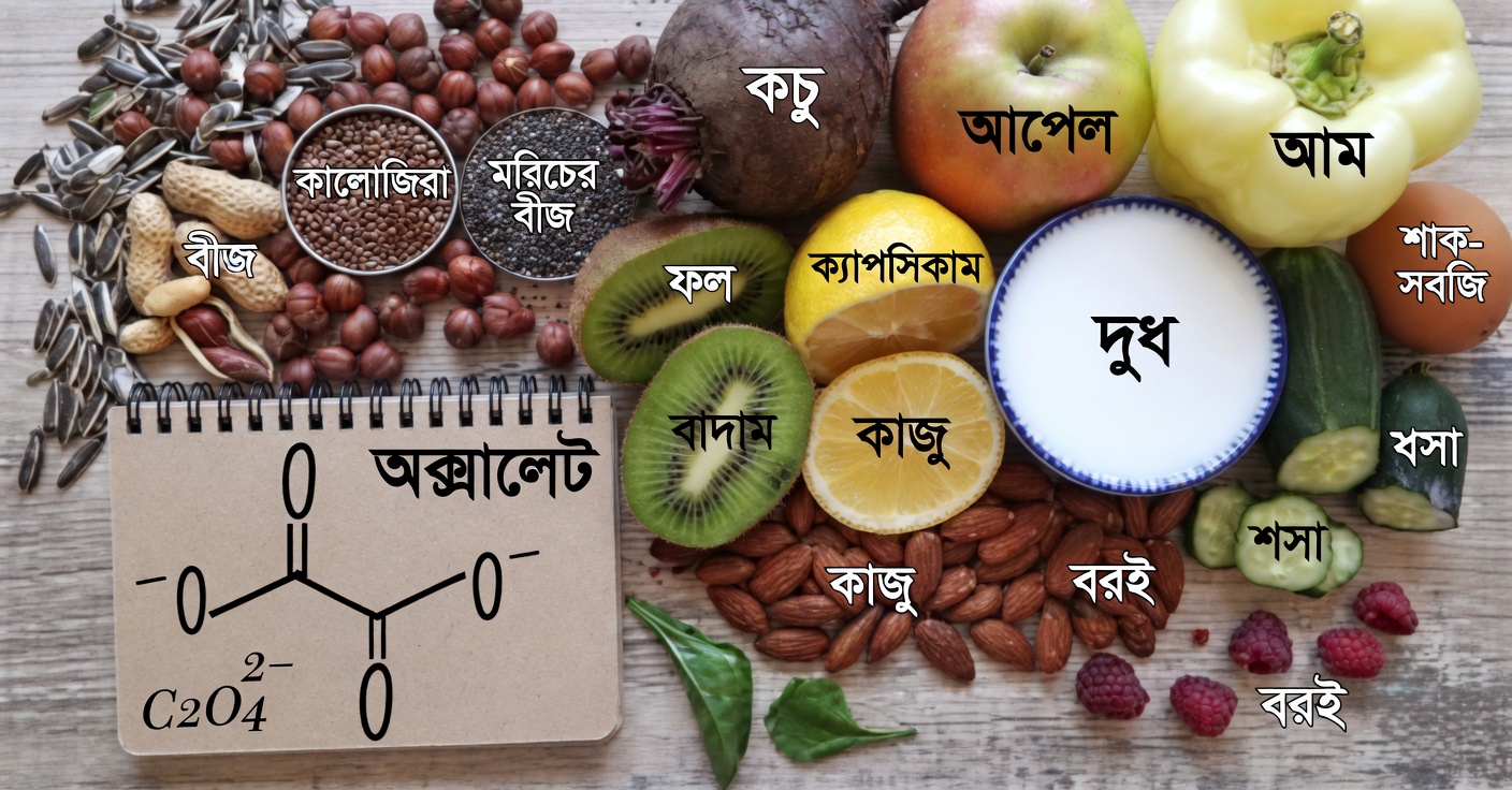 যে খাবারগুলো কিডনিতে পাথরের ঝুঁকি বাড়াতে পারে: বিবেচনার জন্য বুদ্ধিমান পছন্দগুলো