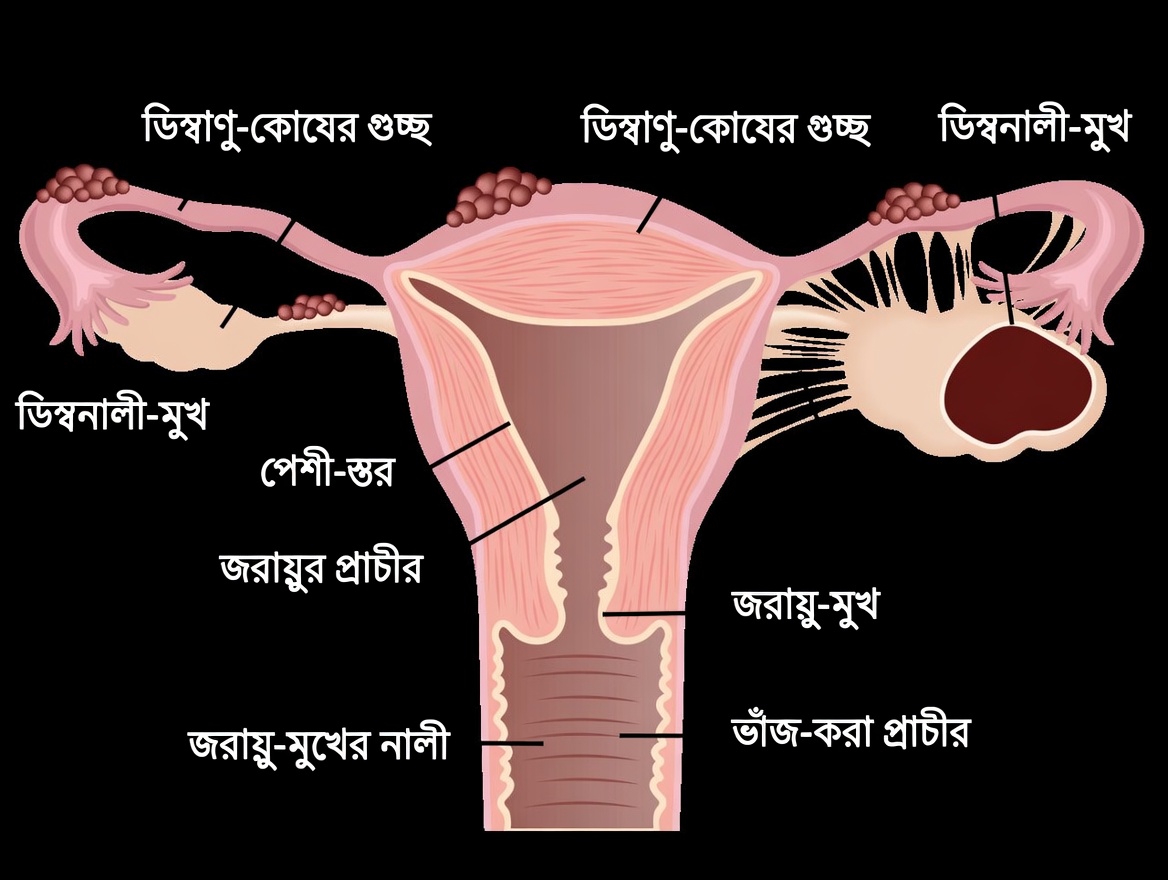 এন্ডোমেট্রিওসিসের সতর্কবার্তা: প্রতিদিনের যেসব অভ্যাস আপনার উপেক্ষা করা উচিত নয়