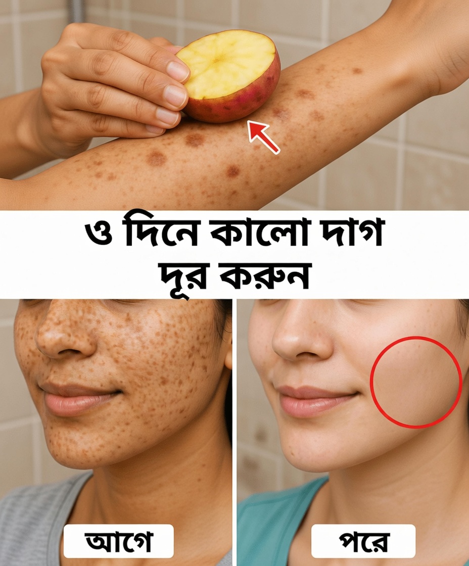 বয়সের দাগ, মেলাজমা, সান স্পট, দাগ-ছোপ এবং বয়সের লক্ষণ দূর করুন।