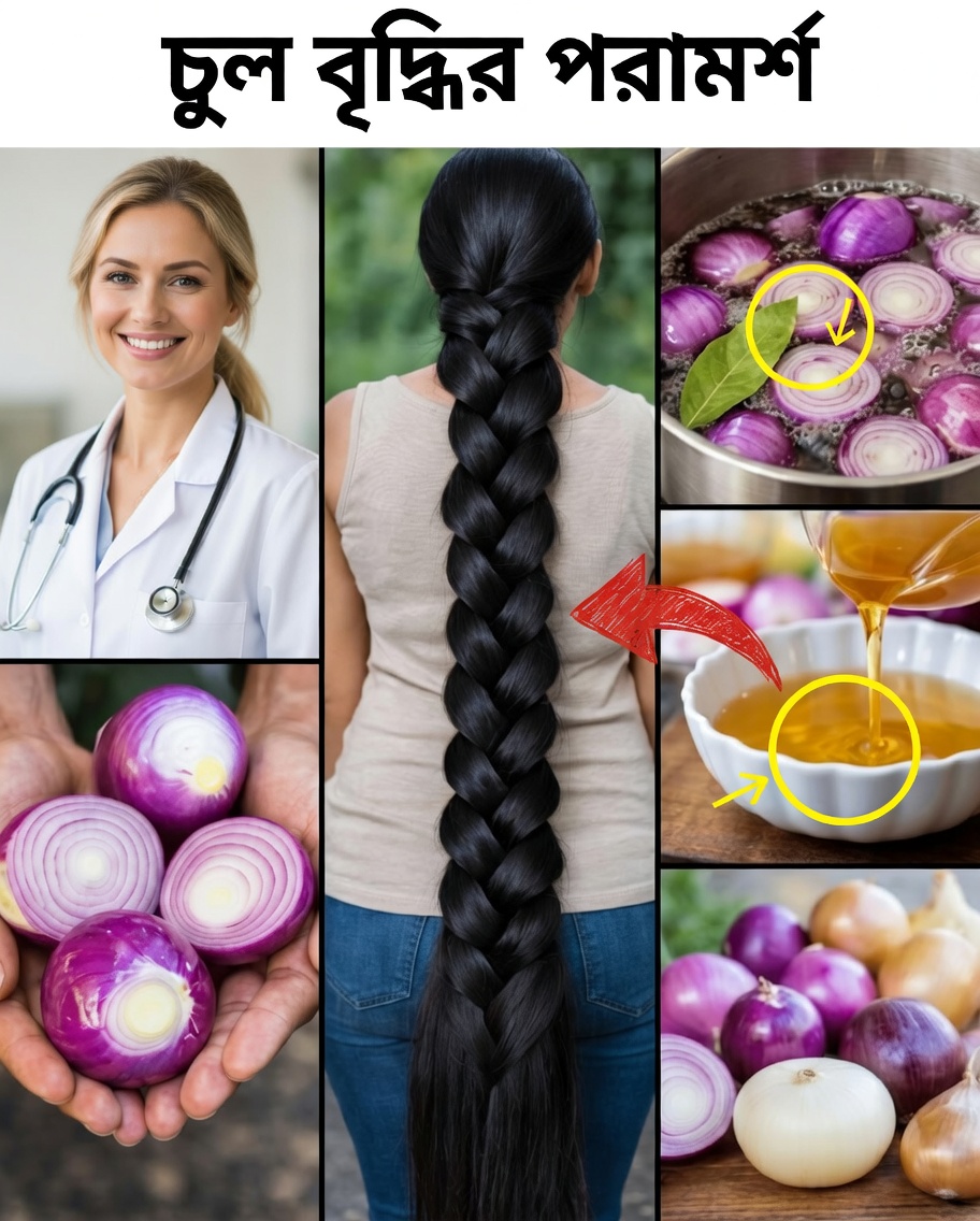 রাতে মাথার ত্বকে কাঁচা পেঁয়াজ ঘষা: সবার মুখে মুখে ঘুরছে এই চুলের বিস্ময়কর রীতি