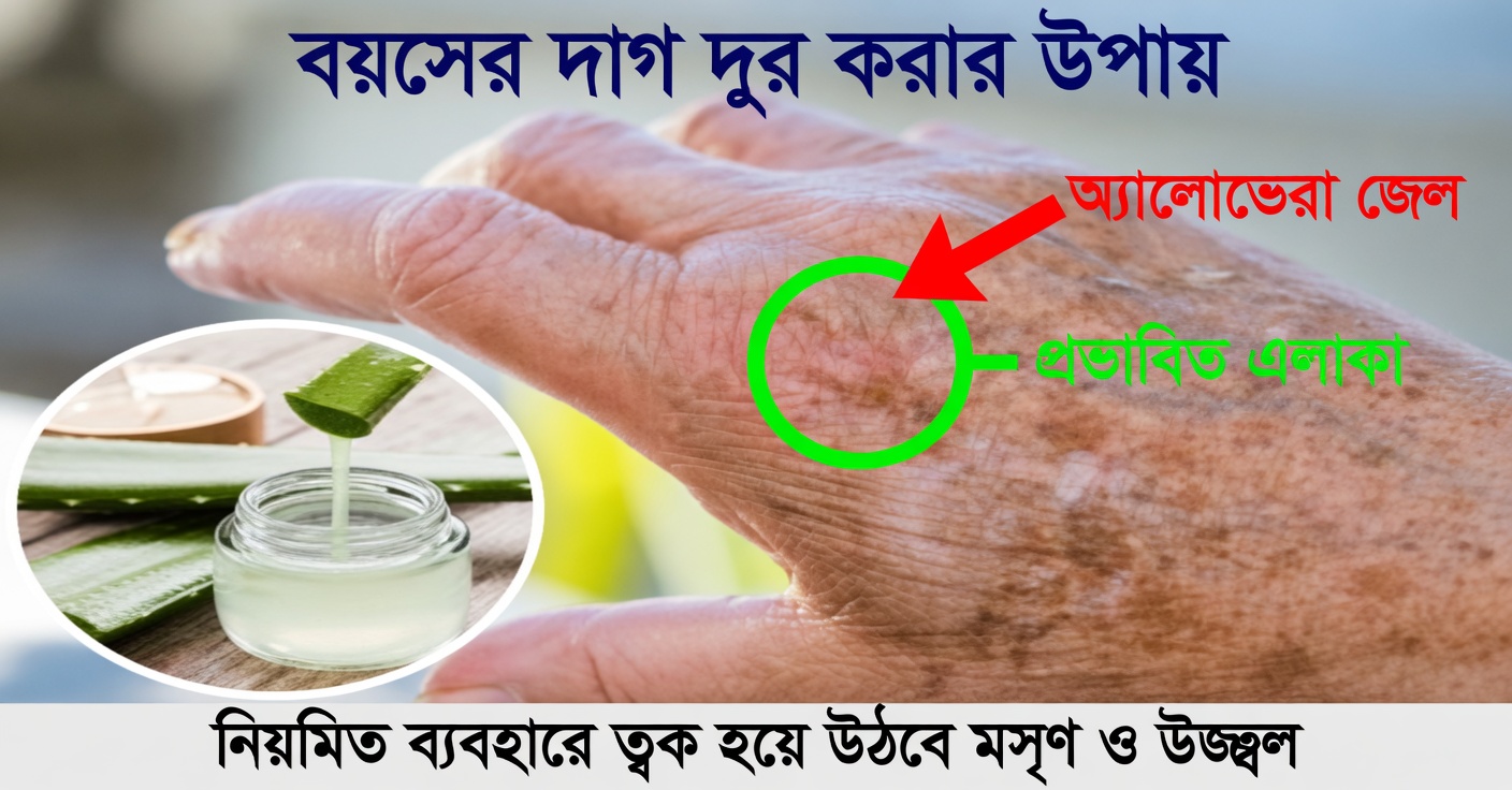 হাতে দাগ কীভাবে দূর করবেন