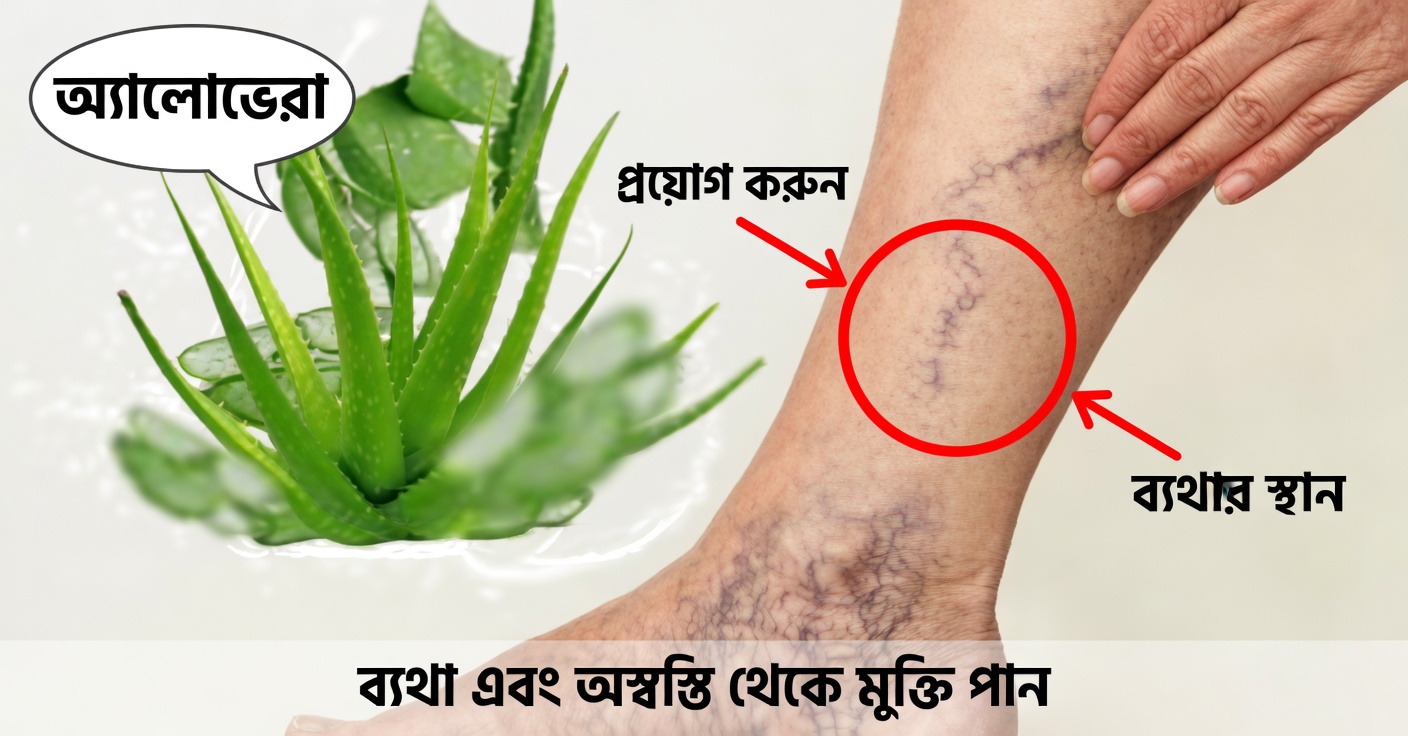 ভ্যারিকোজ শিরা ও ক্লান্ত পায়ের জন্য অ্যালোভেরা: প্রাকৃতিক প্রতিকার