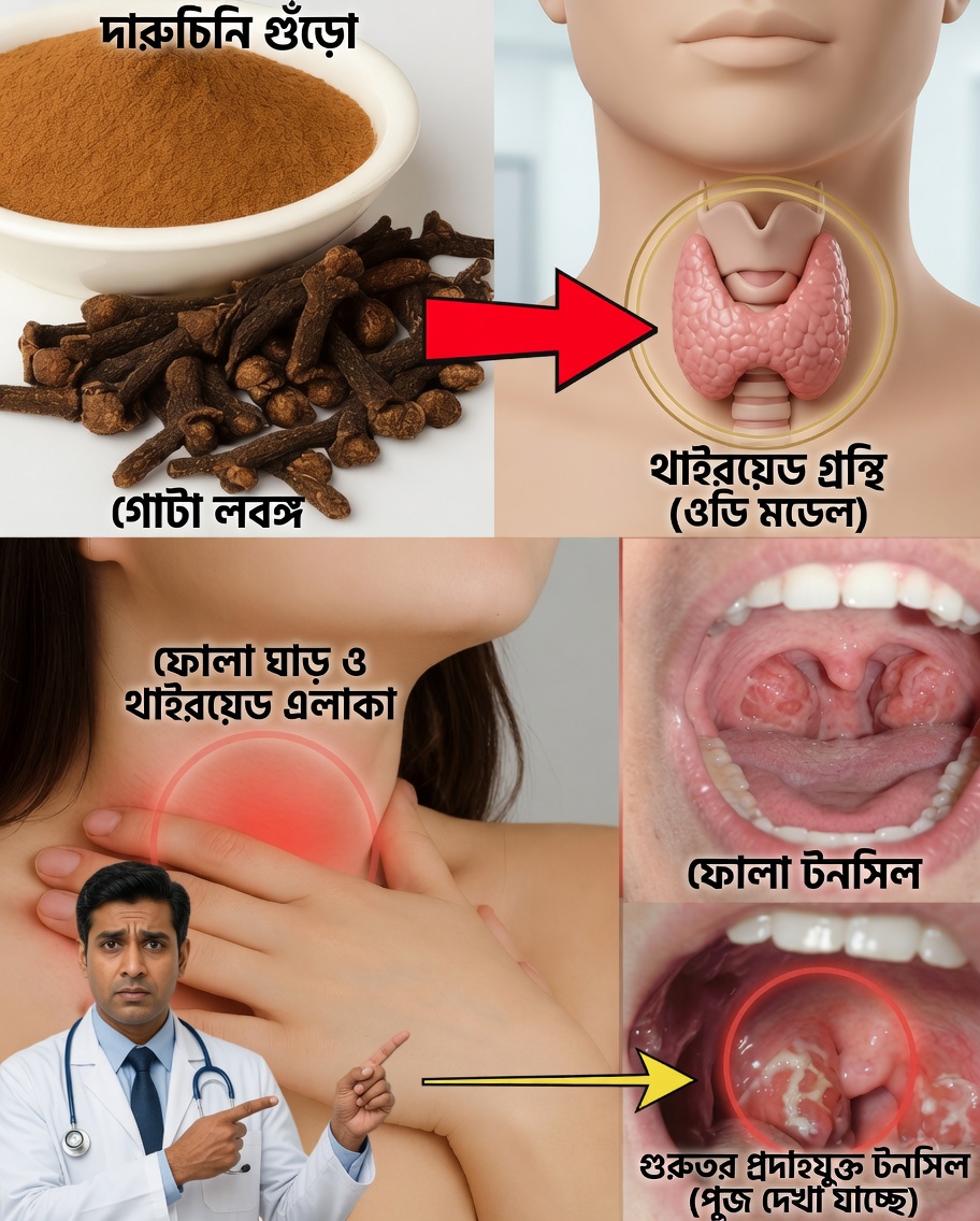 লবঙ্গ: গলা ব্যথা উপশম করে এবং দ্রুত প্রদাহের বিরুদ্ধে লড়ে এমন ক্ষুদ্র প্রাকৃতিক প্রতিকার