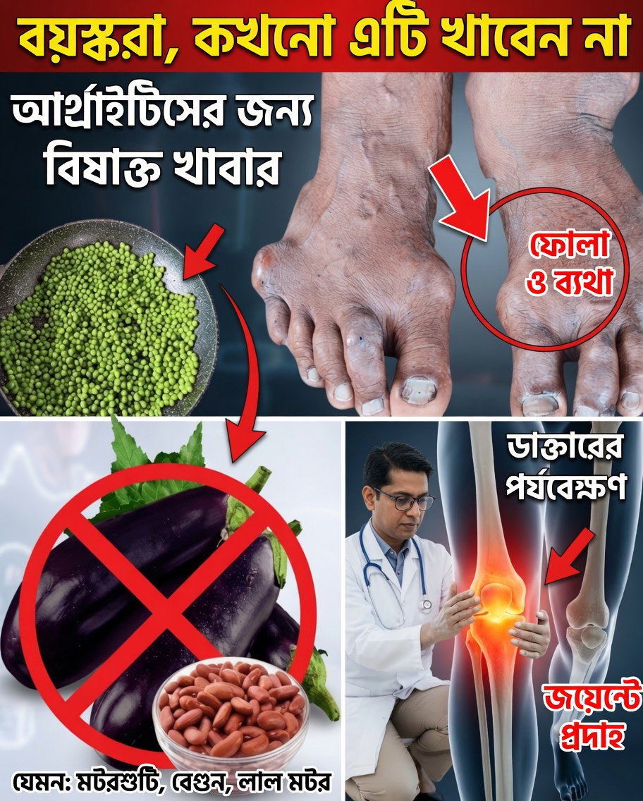 বয়স্করা সতর্ক থাকুন: প্রতিদিনের ১০টি খাবার যা আপনার আর্থ্রাইটিসের ব্যথা আরও বাড়িয়ে দিতে পারে