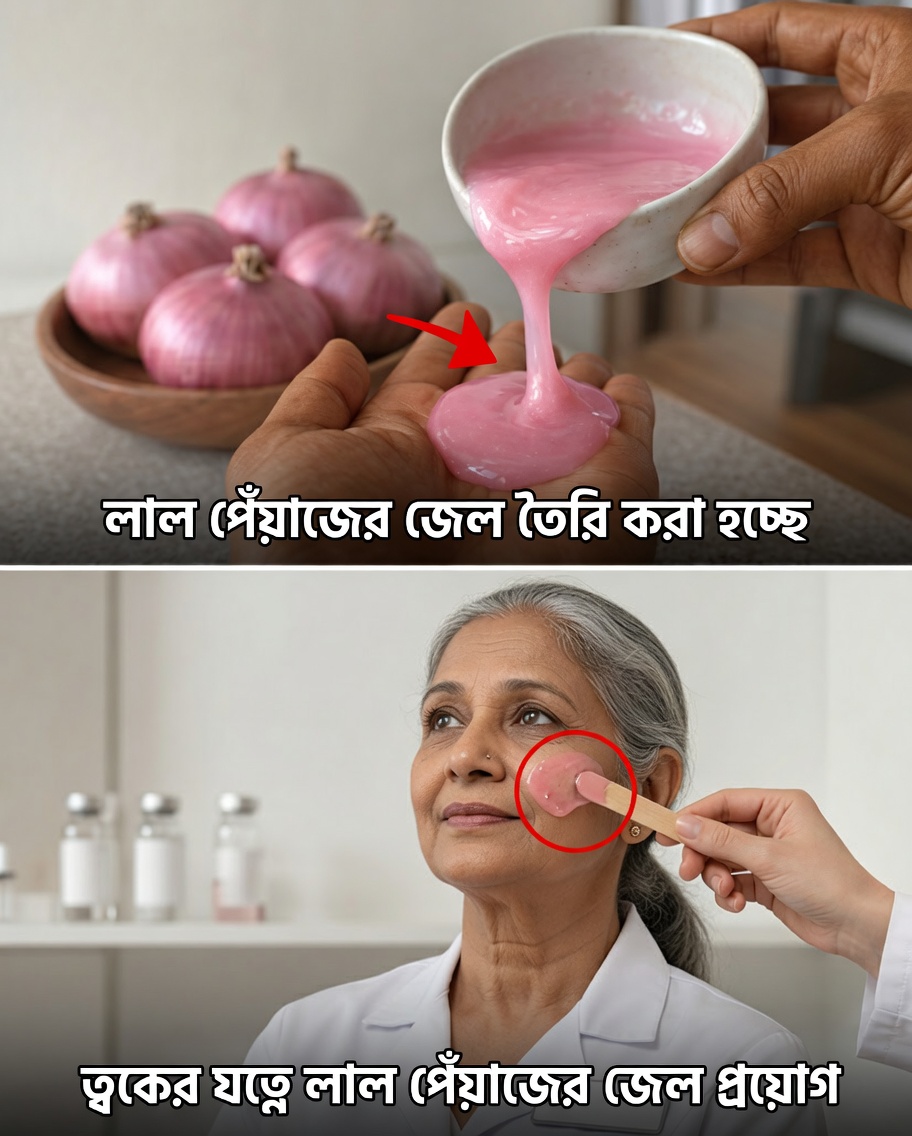 মুখের জন্য বেগুনি পেঁয়াজ: প্রাকৃতিক কৌশল যা হাজারো মানুষ বলিরেখা, কালো দাগ ও পিগমেন্টেশন কমাতে ব্যবহার করছে