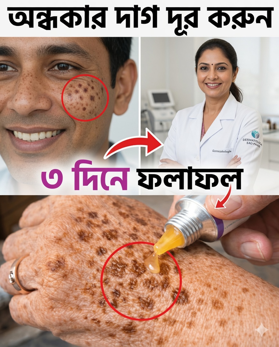 প্রাকৃতিকভাবে বয়সের দাগ দূর করুন: আরও উজ্জ্বল ও সমান ত্বকের জন্য কর্নস্টার্চ, বেকিং সোডা ও লেবুর সহজ মাস্ক