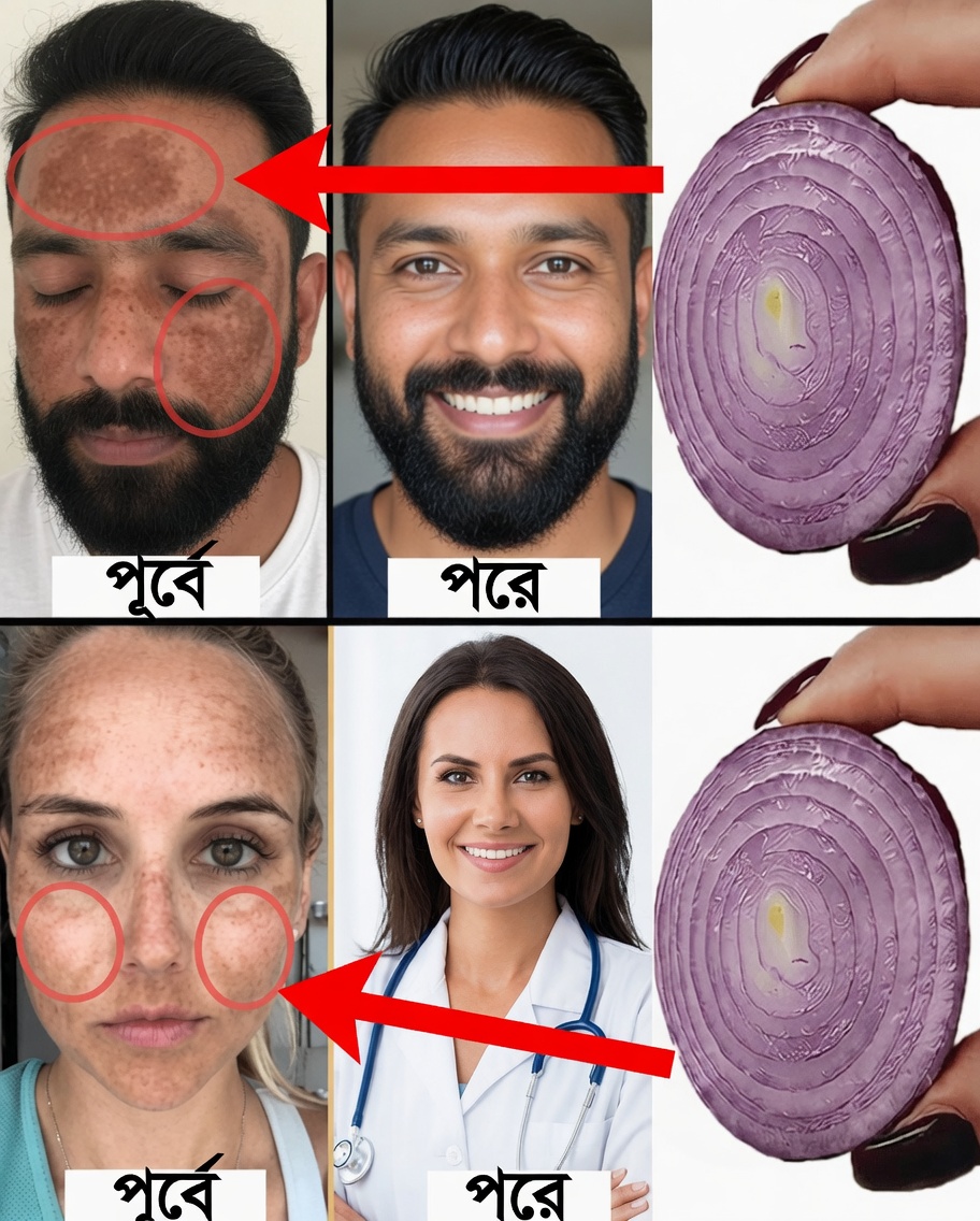 তুষার-সাদা, কাঁচের মতো স্বচ্ছ ত্বকের জন্য পেঁয়াজের সঙ্গে কর্নস্টার্চ মেশান: এমন এক প্রাকৃতিক গোপন কথা, যা আপনি আরও আগে জানলে ভালো হতো