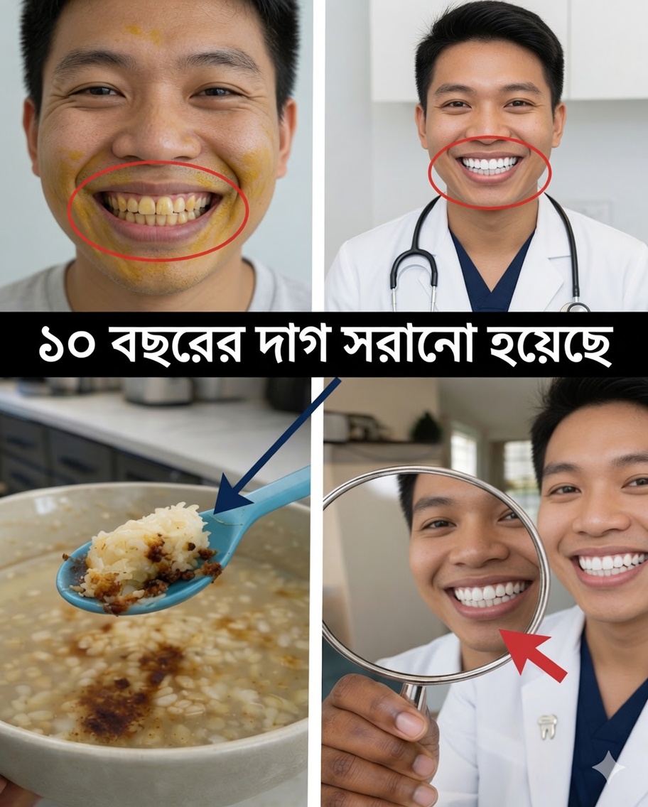 ২ মিনিটে দাঁতের দাগের ১০ বছরের ছাপ মুছে ফেলবেন? যে সত্যটি আপনাকে অবাক করবে