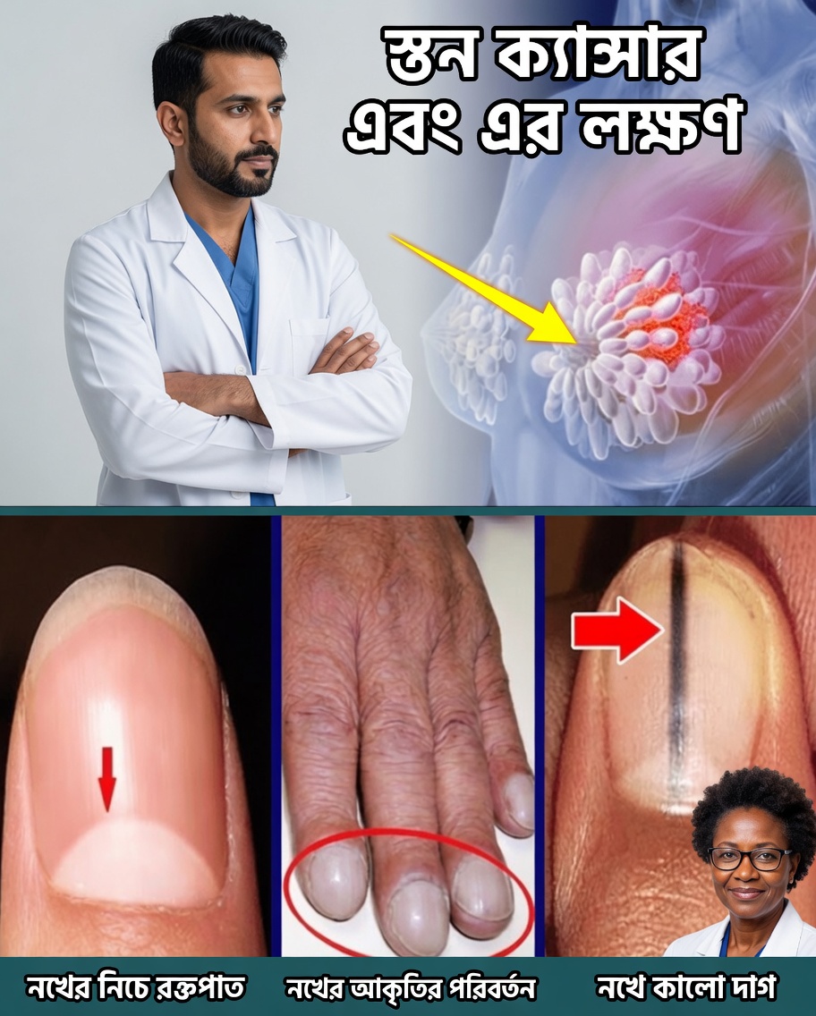 নারীদের কখনোই উপেক্ষা করা উচিত নয় এমন ক্যানসারের ১৪টি নীরব সতর্ক সংকেত