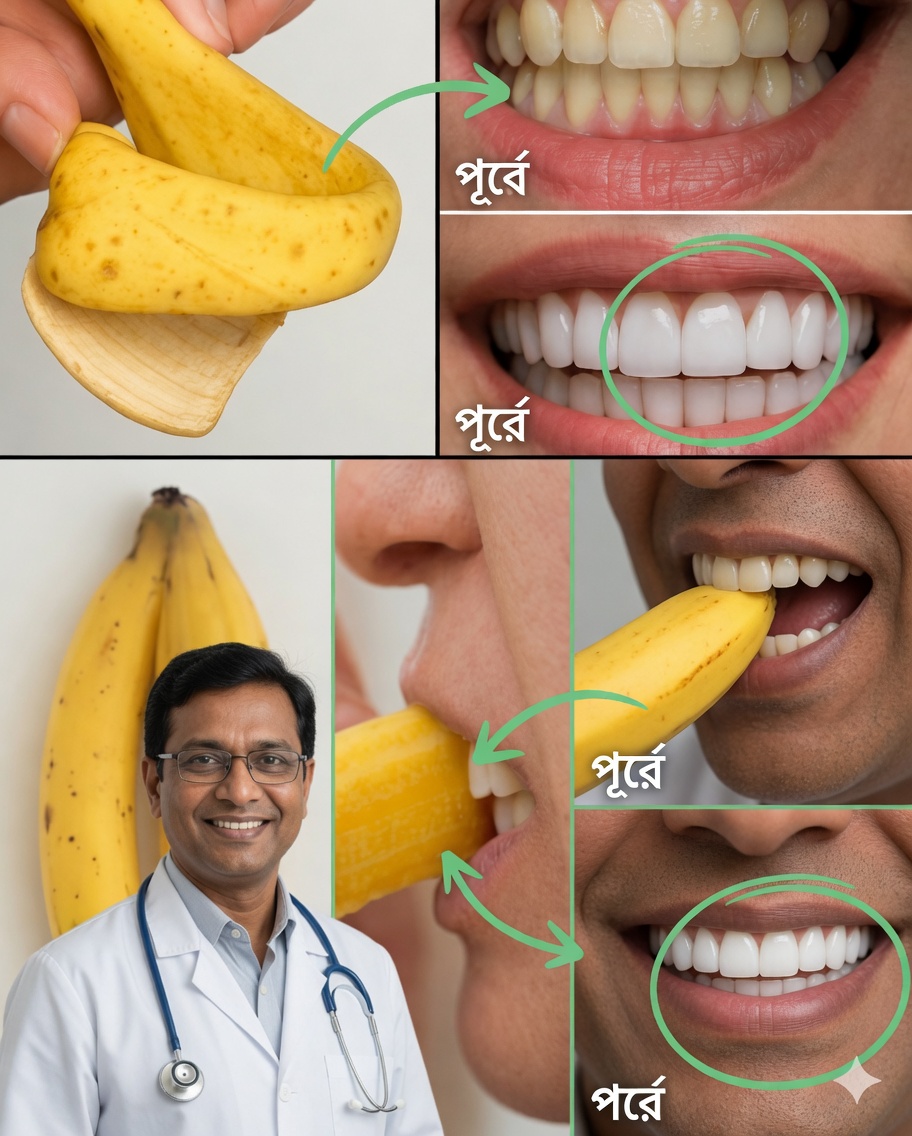 মাত্র ২ মিনিটে কলার খোসা দিয়ে আপনার হাসি উজ্জ্বল করুন