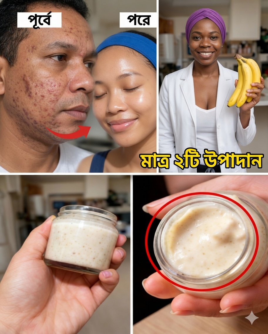 খোসাসহ কলা ব্যবহার করে সূক্ষ্ম রেখা মসৃণ করা ও ত্বক উজ্জ্বল করার ৭টি প্রাকৃতিক উপায়