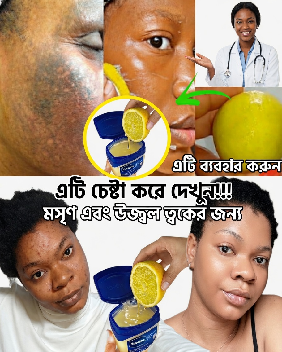 ভ্যাসেলিন ও লেবু আরও উজ্জ্বল ও মসৃণ ত্বকের জন্য