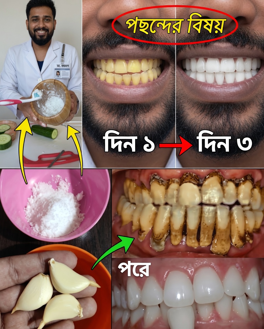 আগের মতো কখনো নয় এমনভাবে হাসুন: বাড়িতে মনোমুগ্ধকর হাসির গোপন রহস্য আবিষ্কার করুন