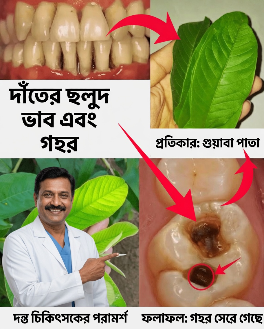 পাতার পেয়ারা পাতার সাহায্যে দাঁতের ক্ষয় চিকিৎসার ৩টি সহজ ও সাশ্রয়ী উপায়