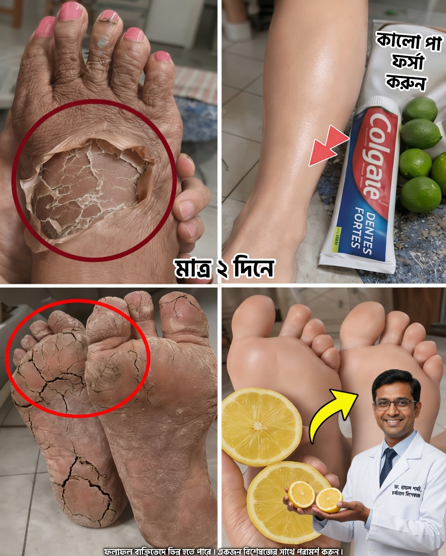সহজ দৈনন্দিন অভ্যাস, যা মসৃণ, উজ্জ্বল ও স্বাস্থ্যকর ত্বকের জন্য আমার পায়ের ত্বকের চেহারা উন্নত করেছে