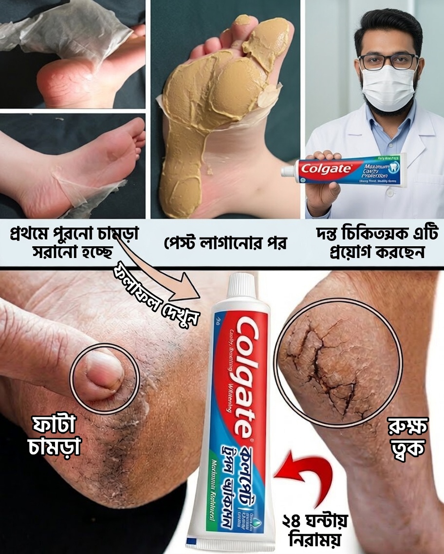 কলগেট দিয়ে পায়ের যত্নের গোপন কৌশল: নরম ও স্বাস্থ্যকর পায়ের জন্য একটি সহজ ট্রিক