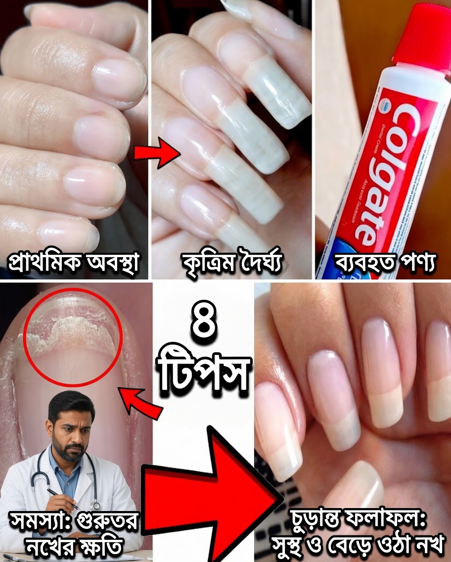 দুর্বল নখকে প্রাকৃতিকভাবে পুনরুজ্জীবিত করুন: আরও শক্তিশালী ও স্বাস্থ্যকর নখের জন্য শক্তিশালী রসুনের গোপন রহস্য