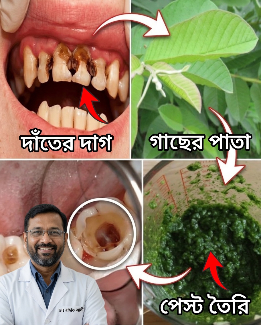 উজ্জ্বল হাসির জন্য পেয়ারা পাতা: ৭০ বছর বয়সী এক দাদীর কাছ থেকে প্রজন্মান্তরে পাওয়া প্রাকৃতিক মুখের যত্নের গোপন রহস্য